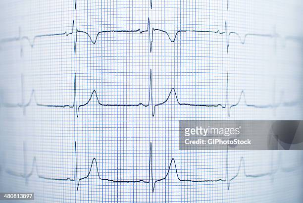 healthy electrocardiogram - pulse trace stockfoto's en -beelden