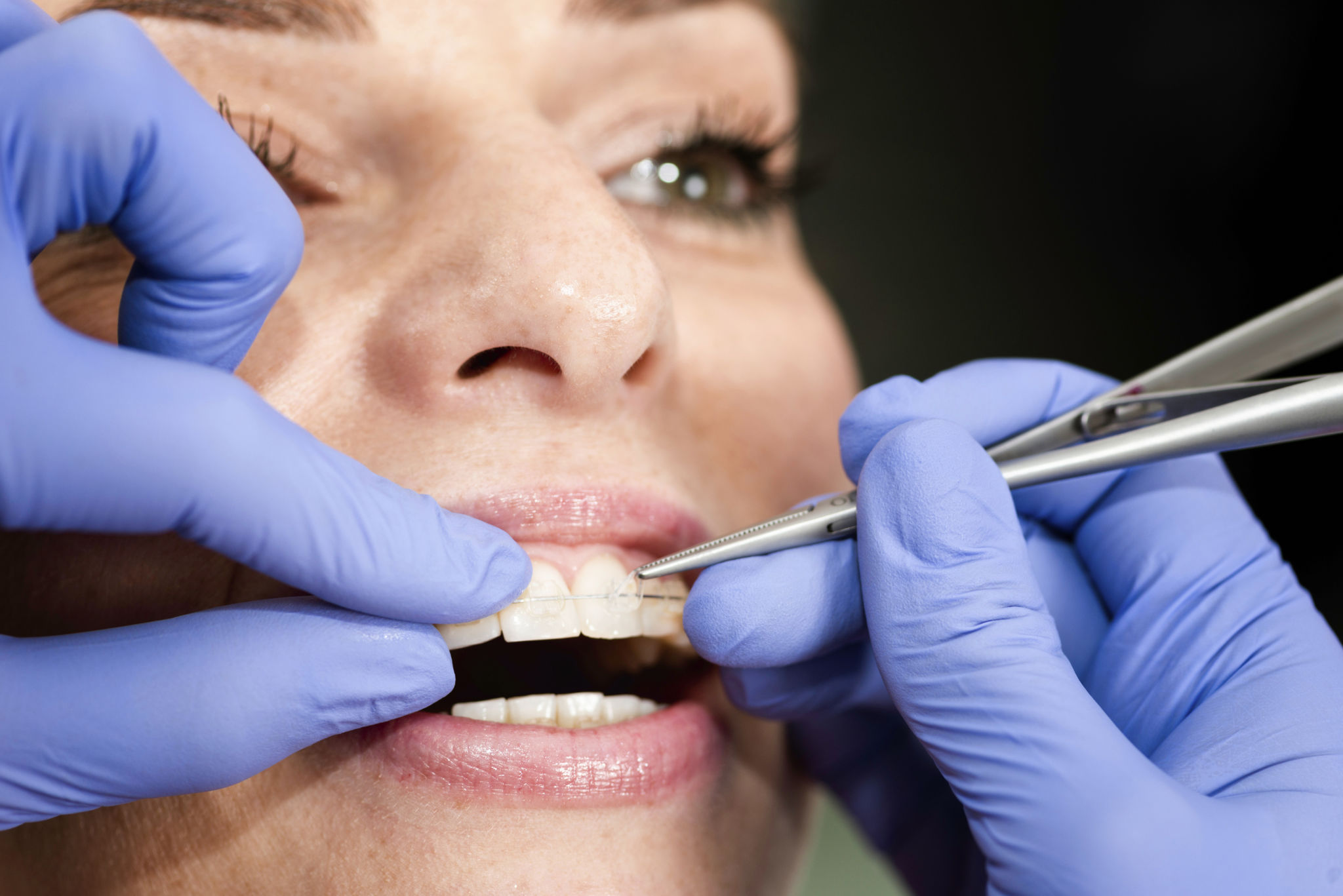dentist braces