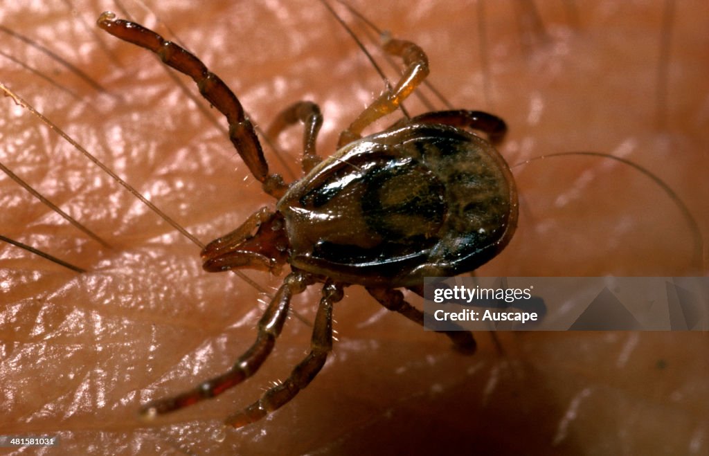 Paralysis tick