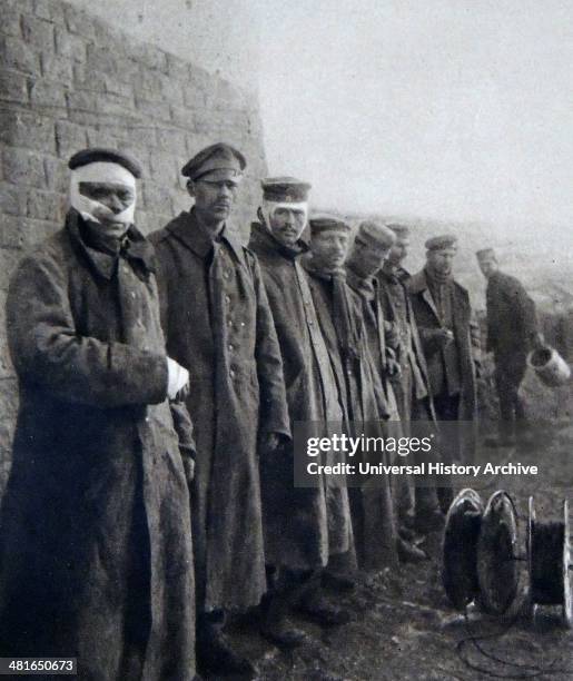 World War I - german wounded soldiers during the 1916 Second Battle of Verdun offensive..