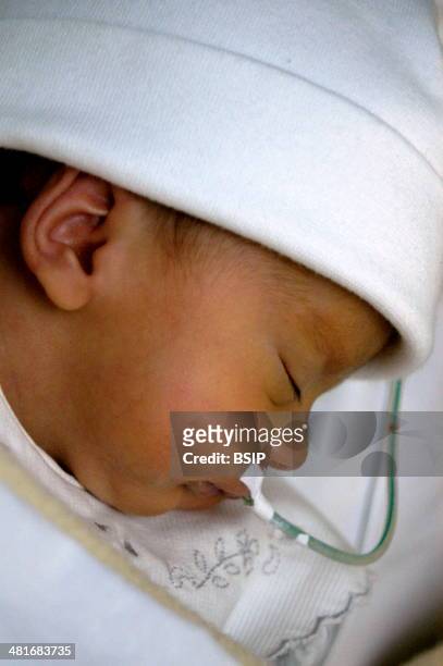 Reportage in the neonatal unit of Robert-Debre hospital in Paris, France. Feeding tube.