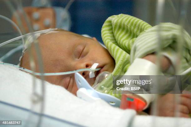 Reportage in the neonatal unit of Robert-Debre hospital in Paris, France. Feeding tube.