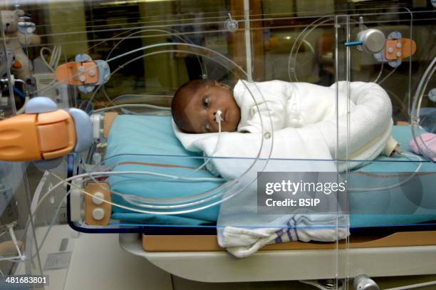 Reportage in the neonatal unit of Robert-Debre hospital in Paris, France. Premature baby in an incubator with a feeding tube.