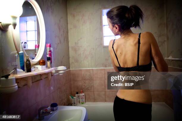 Reportage on a woman suffering from anorexia. Christel has suffered from anorexia for 2 years. Her body mass index is 16.7 and is extremely thin. She...