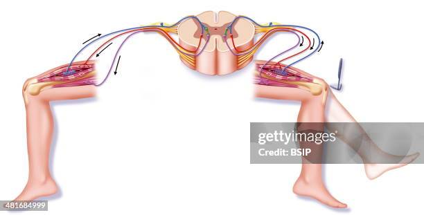 Illustration of the patellar reflex. On the left, an illustration of the nerve signal with, in blue, the journey of the afferent impulse from the...