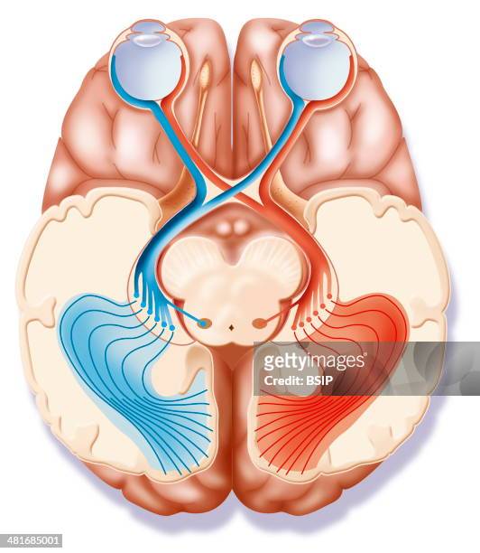 The optic tract. The transmission of visual information takes place from the retina, via the optic nerve, to the visual cortex. Some information...