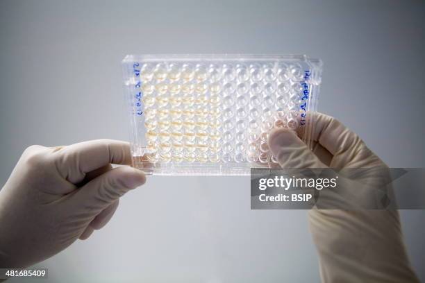 Reportage in a laboratory which develops therapeutic vaccinations to treat small-cell lung cancer, using optimised cryptic peptide technology. These...