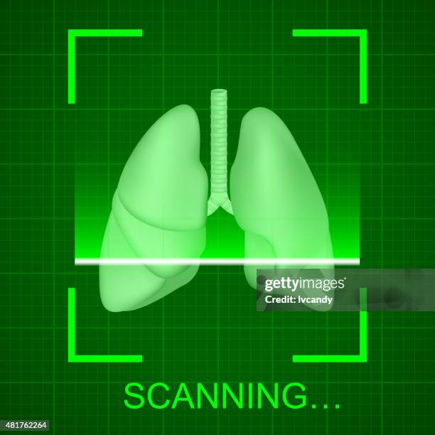 lung examination - cat scan stock illustrations