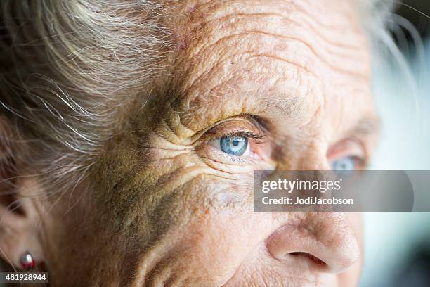 abused caucasian senior woman with black eye - close up eye stockfoto's en -beelden