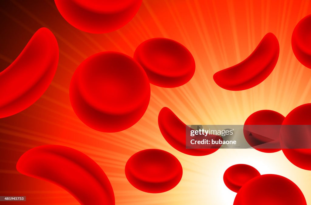 Sickle cell Red cells in Blood Stream