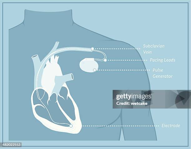 pacemaker blueprint - heart internal organ stock illustrations