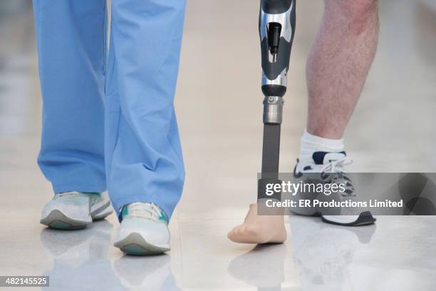 nurse helping man walk with prosthetic leg - amputé photos et images de collection
