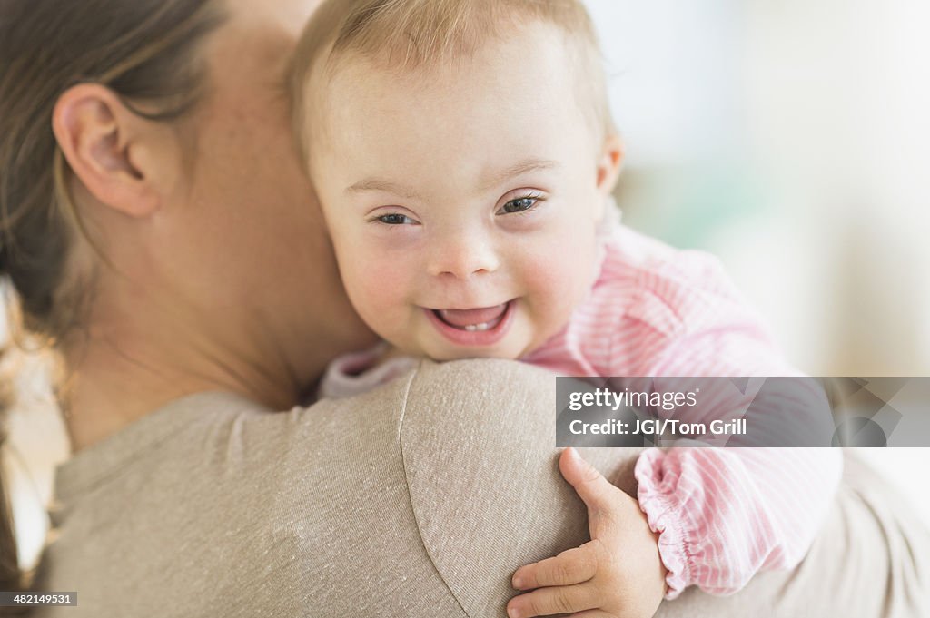 Caucasian mother holding baby girl with Down Syndrome