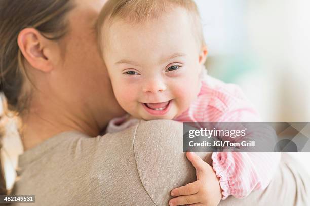 caucasian mother holding baby girl with down syndrome - down syndrome baby stockfoto's en -beelden