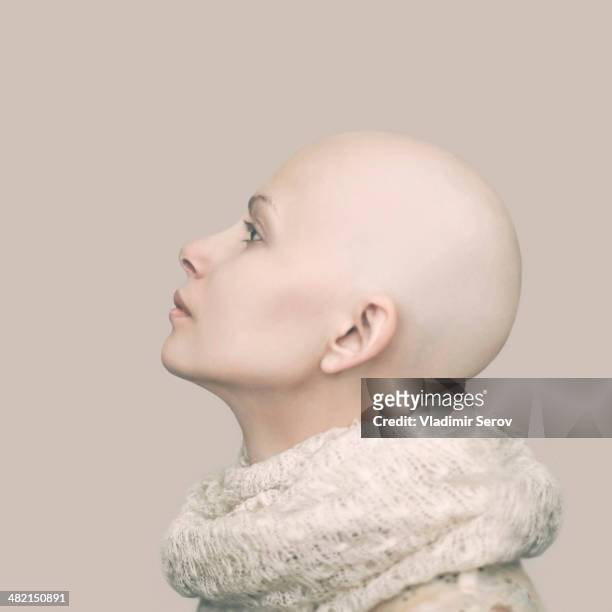 caucasian woman with bald head - hair loss stock pictures, royalty-free photos & images