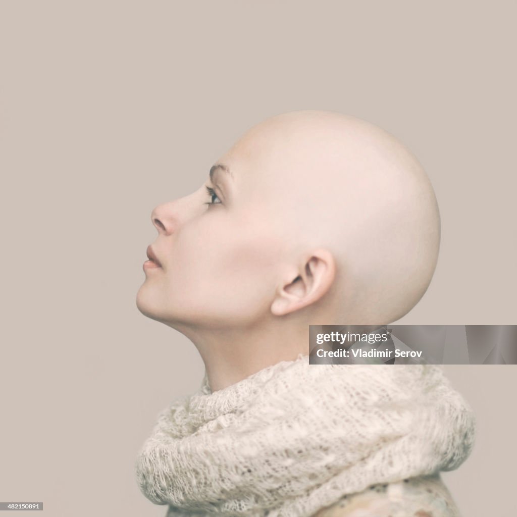 Caucasian woman with bald head