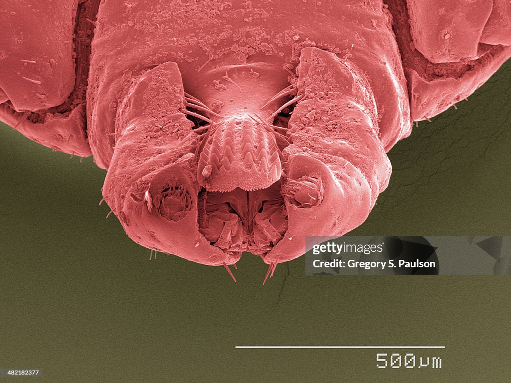 Coloured SEM of tick's mouthparts