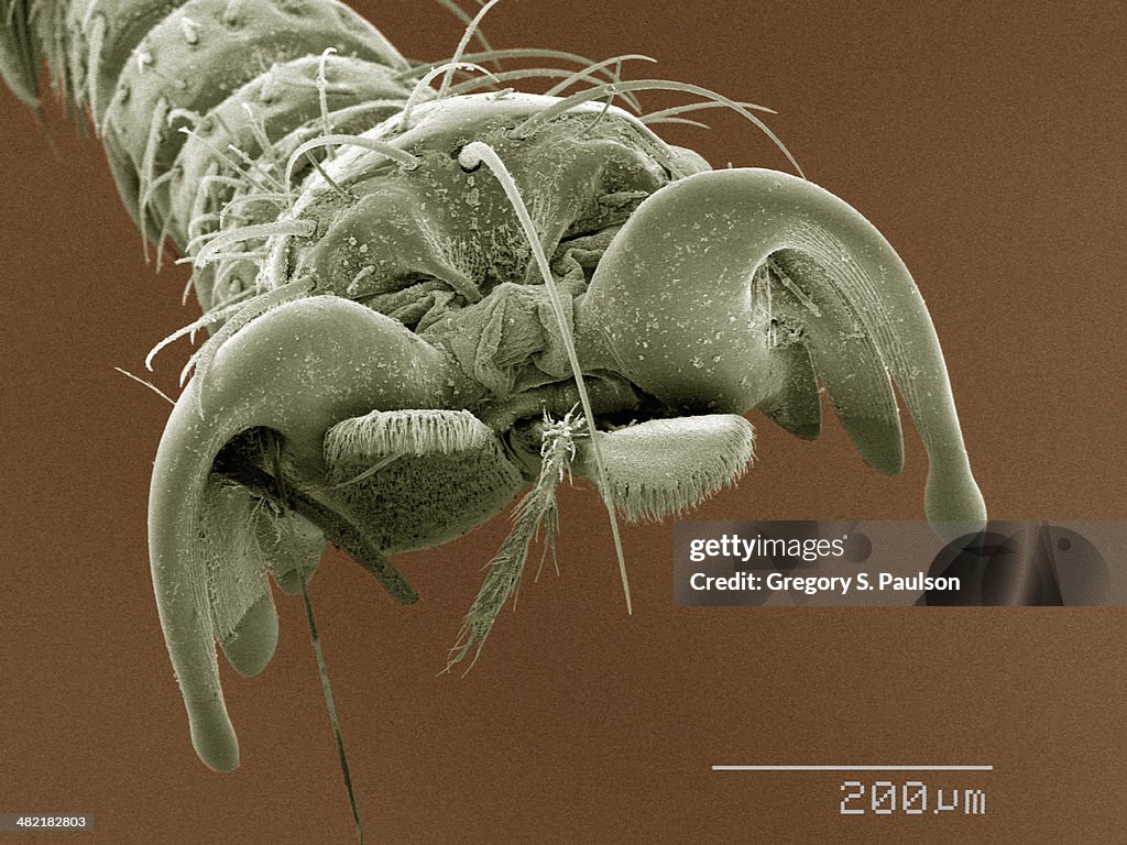 Coloured SEM of louse fly (Hippoboscidae) tarsus