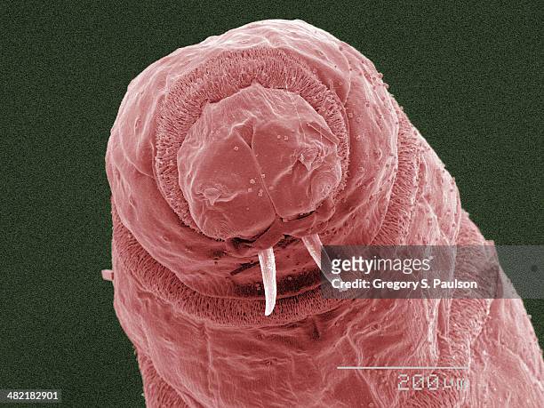 coloured sem of fly maggot mouthparts - maggots stock-fotos und bilder