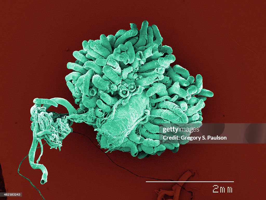 Cockroach Intestines Coloured Sem Of American Cockroach Gut And Malpighian Tubuoles High-Res ...