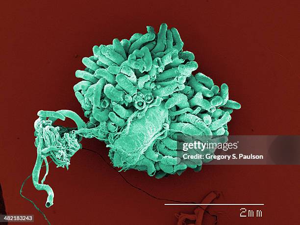 coloured sem of american cockroach gut and malpighian tubuoles - american cockroach stock pictures, royalty-free photos & images