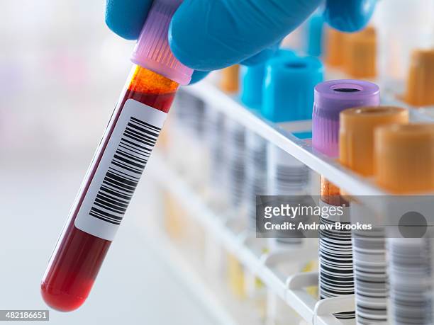 a blood sample being held with a row of human samples for analytical testing including blood, urine, chemistry, proteins, anticoagulants and hiv in lab - blood testing photos et images de collection