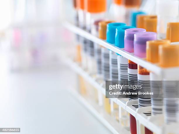 a row of human samples for analytical testing including blood, urine, chemistry, proteins,anticoagulants and hiv in lab - specimen holder stock pictures, royalty-free photos & images