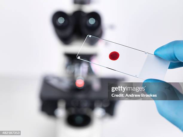 laboratory scientist holding a slide containing a blood sample with a upright compound microscope in the background - lâmina-de-microscópio - fotografias e filmes do acervo