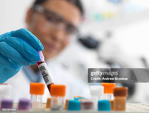 female scientist about to view a human sample under a microscope - hematología fotografías e imágenes de stock