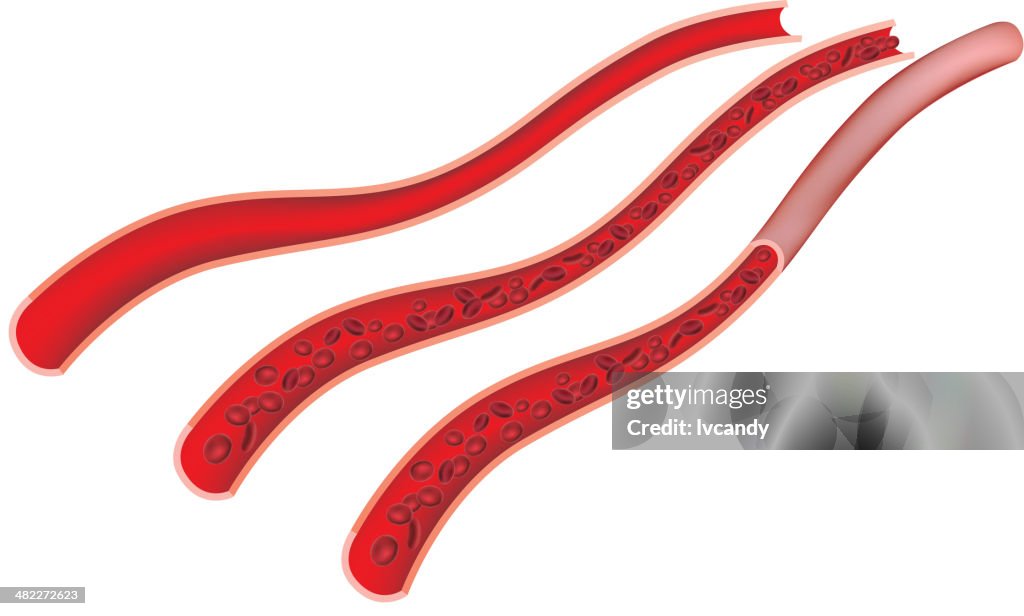 Blood Vessel