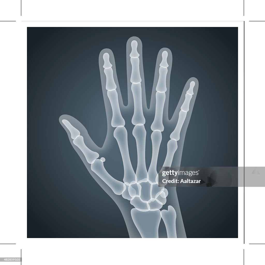 Human Hand X-Ray