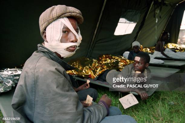 Wounded Rwandan children wait at the french army medical center at the Goma airport in Zaire on July 01, 1994.