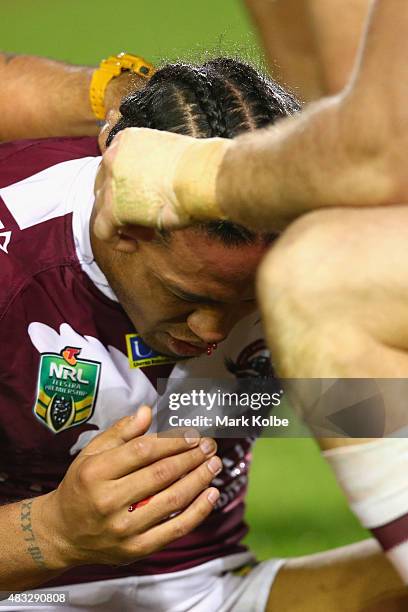 Steve Matai of the Eagles receives attention for a bleeding nose during the round 22 NRL match between the Manly Sea Eagles and the South Sydney...