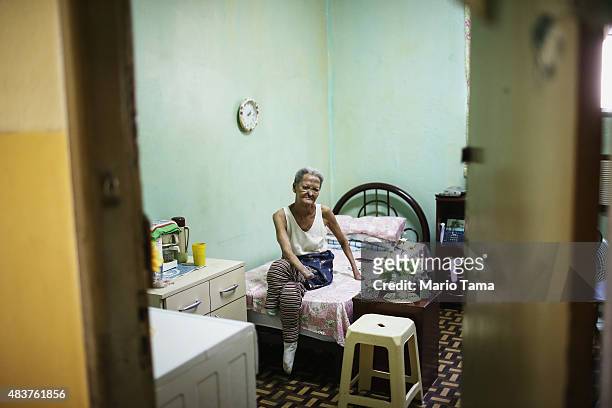 Former leprosy patient Tereza Alves dos Santos sits in her room in Hospital Curupaiti, part of a former leprosy colony, on June 10, 2015 in the...
