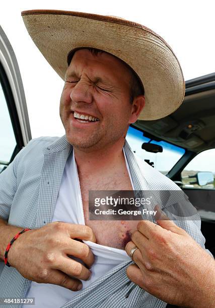 Rancher Cliven Bundy's son, Ammon Bundy grimaces as he shows taser marks on his chest on April 11, 2014 west of Mesquite, Nevada. Ammon was taserd...