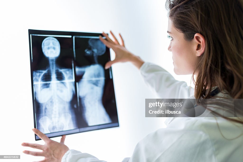 Doctor examining x-ray