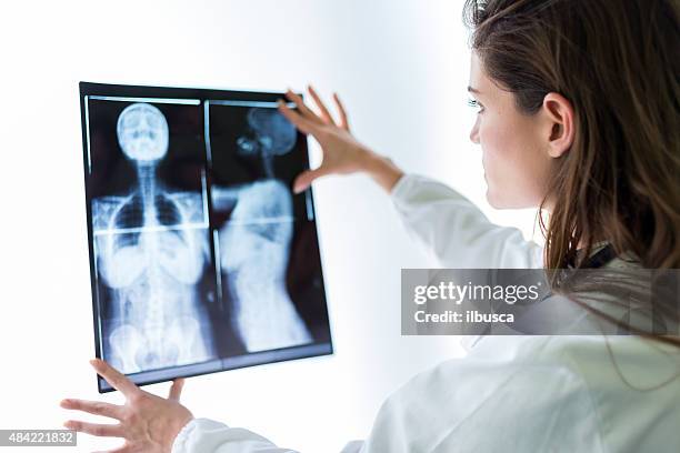 doctor examining x-ray - diagnostic medical tool stock pictures, royalty-free photos & images