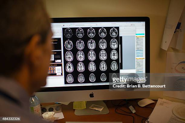 Toronto Star reporter Joe Hall's brain scan images taken during his visit to the Toronto Western Hospital's MRI room on July 29, 2015. A machine...