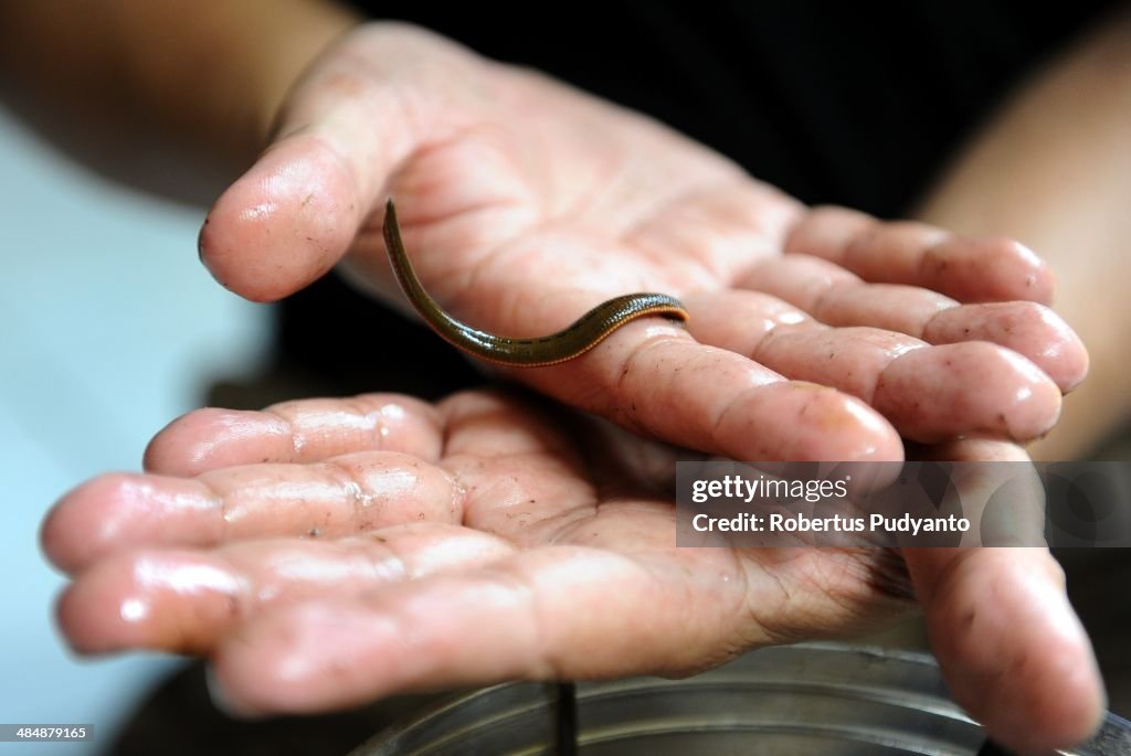 Leeches Farmed For Medical Therapy