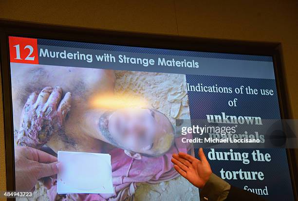 Forensic pathologist Dr. Stuart Hamilton gives a report on the allegations of torture in Syria at the United Nations on April 15, 2014 in New York...