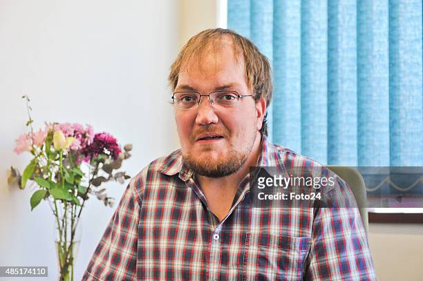 Timothy Dreyer, a sclerosteosis sufferer during an interview on August 19, 2015 in Pretoria, South Africa. Dreyer, a PhD student in paraclinical...