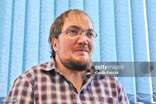 Timothy Dreyer, a sclerosteosis sufferer during an interview on August 19, 2015 in Pretoria, South Africa. Dreyer, a PhD student in paraclinical...