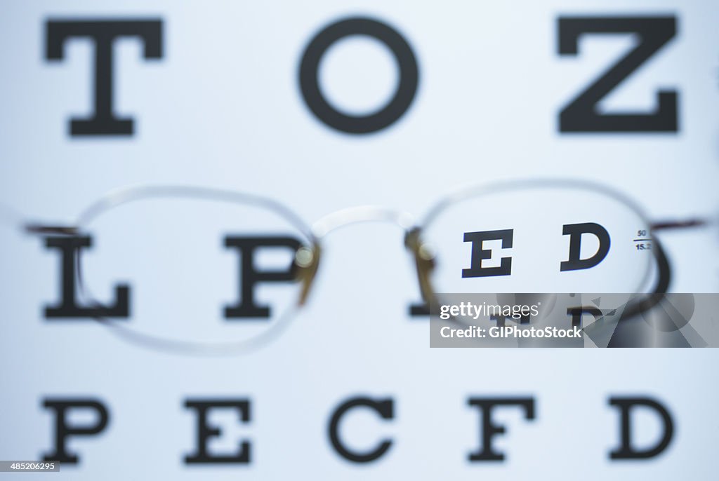 Spectacles with one myopic lens (negative) and the other is missing are used to look at the Snellen eye chart. The image is in focus when looking through the lens