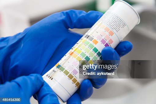 Urine test strips Urine test strips