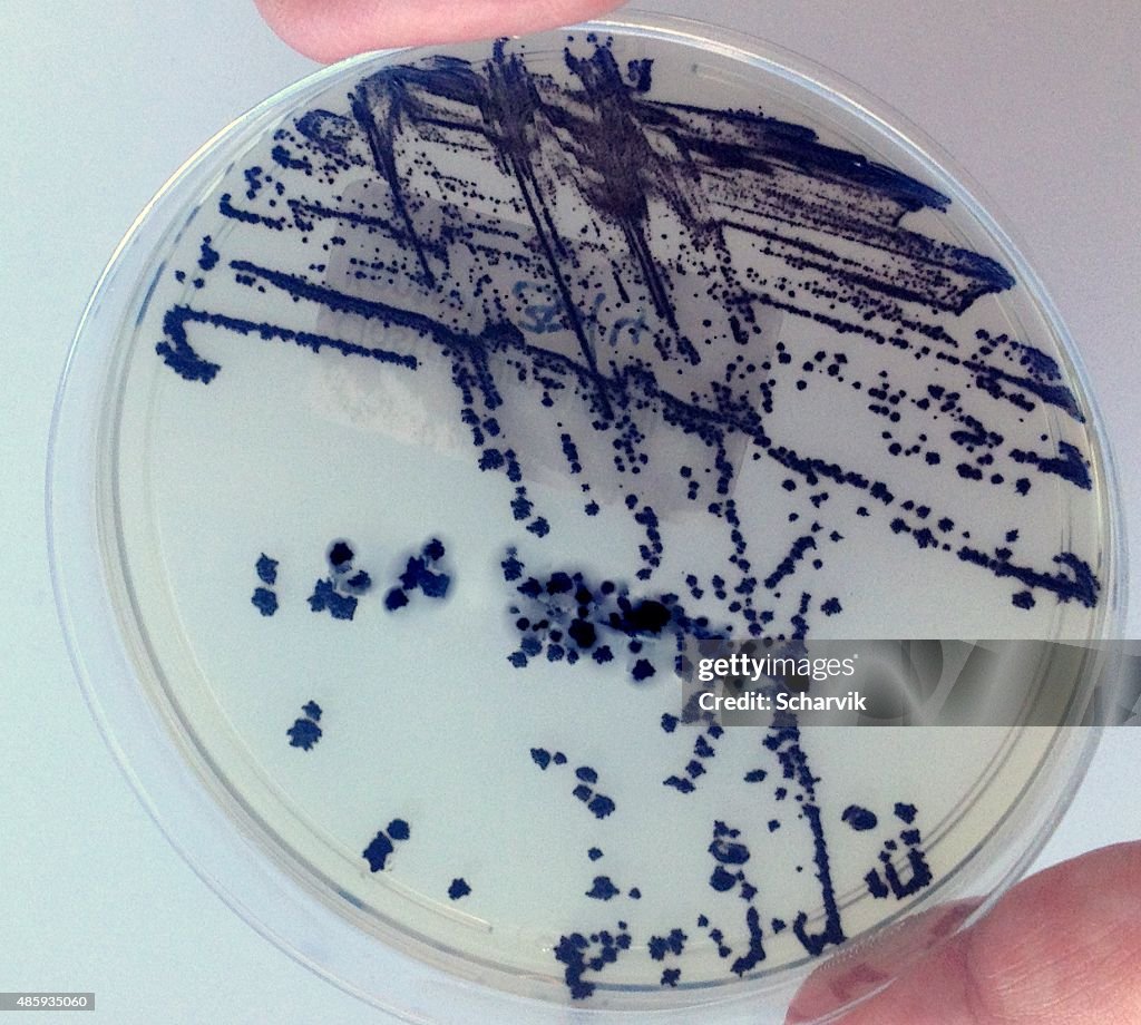 Clostridium difficile 027