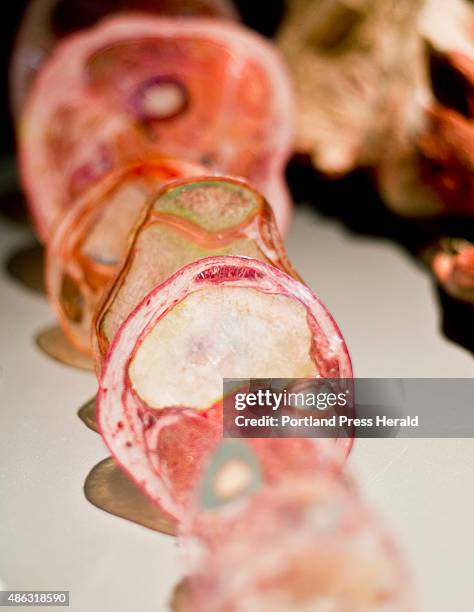 Body World exhibit, showing the tissue, ligaments and bone of a human leg at the Portland Science Center in Portland, ME on Wednesday, September 2,...