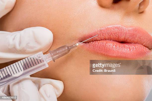 close up of having beauty treatment with botox. - facelift stock pictures, royalty-free photos & images