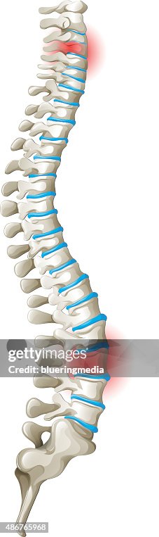 Spine Back Pain Diagram High-Res Vector Graphic - Getty Images