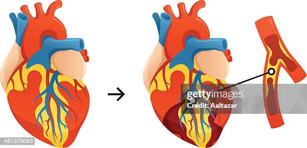 illustrazioni stock, clip art, cartoni animati e icone di tendenza di attacco di cuore - human artery