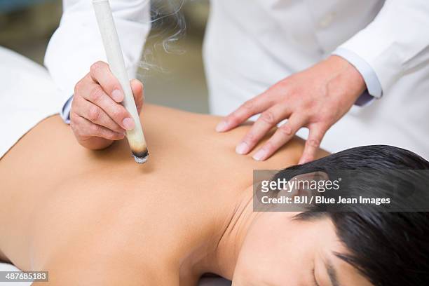 patient receiving moxibustion - acupuncture elderly stock pictures, royalty-free photos & images